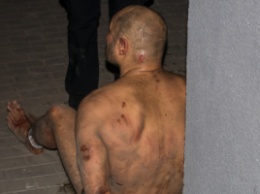 Голый и окровавленный: в Киеве неадекватный мужчина бил стекла и бросался шлакоблоками