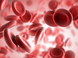 Признаки анемии: 5 лучших домашних средств лечения анемии