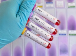 Специалисты обеспокоены рекордным числом случаев ВИЧ в США в 2017 году