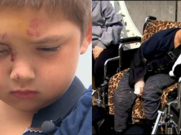 6-летний малыш заступился за друг - и был жестоко избит. Но герой же!
