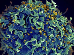 Иммунотерапия ВИЧ прошла первую фазу клинических испытаний