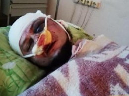 Активисту "Нацдружин", боровшемуся с наркорекламой в Павлограде, проломили голову