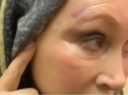 Известной российской актрисе едва не раздавило голову в метро. ФОТО, ВИДЕО