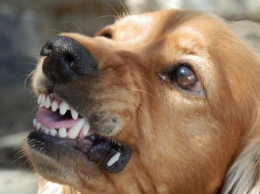В Ивановской области мальчик умер из-за вируса бешенства после укуса собственной собаки