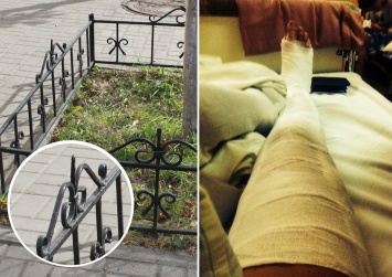 Шел в цирк, попал в больницу: маленькому киевлянину распороло ногу оградкой, установленной коммунальщиками
