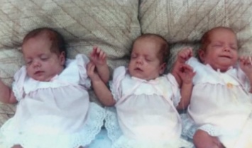 Эти 3 малышки получили тяжелые ожоги. 27 лет спустя они выглядят ТАК!