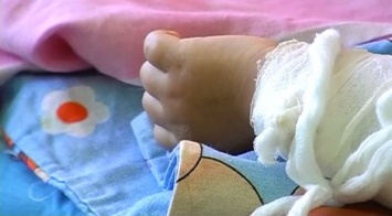В Запорожской области младенца обдало кипятком