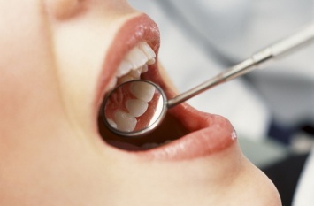 Лечить или не лечить? В Киеве подорожают услуги стоматологов