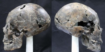 В Южной Корее археологи нашли древний женский череп необычной формы