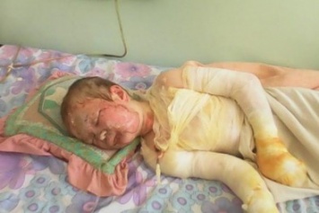 Мать с дочерью, пострадавшие во время взрыва в Мариуполе, находятся в крайне тяжелом состоянии (ФОТО)