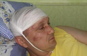 В Конотопе сильно избили депутата от "Свободы"