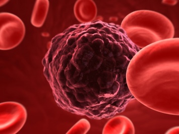 Ученые из США поняли механизм развития рака крови