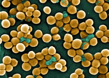 Ученые впервые обнаружили в человеческой слюне бактерии - паразиты бактерий