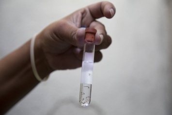 Прототип новой вакцины от вируса Зика признан работающим