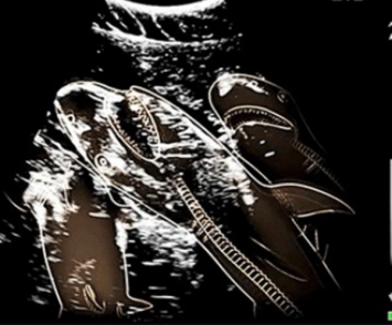 Состоялась первое в мире УЗИ беременной акулы