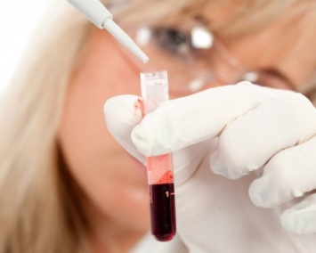 Анализ крови определит потребность в антибиотиках за 30 минут
