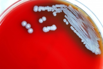 Раскрыт секрет микроба, убивающего человека за 24 часа