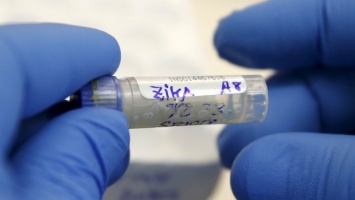 В США погиб первый пациент, заразившийся вирусом Зика