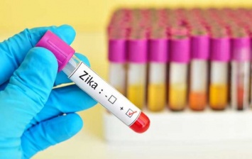 В США зафиксирована первая смерть зараженного вирусом Зика