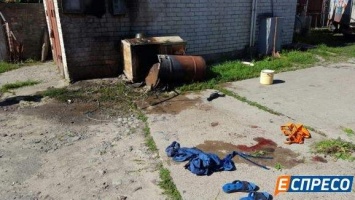 В Киеве мужчина пострадал от взрыва