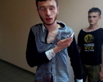 Медведько и Полищук в больнице: последствия избиения спецназом (ФОТО)