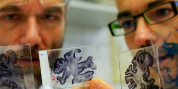 Ученые предупредили, что болезнь Альцгеймера можно выявить в детском возрасте