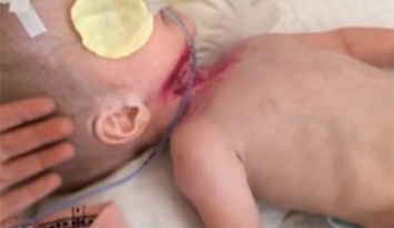 Кровавые раны и сантиметровые ногти: в больница Киева ребенка положили "под замок"