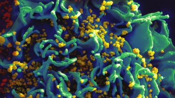 Зоонозная природа ВИЧ впервые подтверждена in vivo