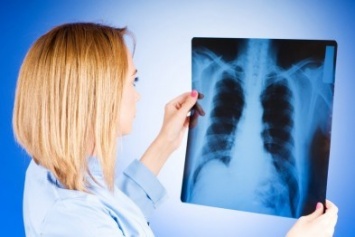 В Мариуполе снизился показатель смертности от туберкулеза
