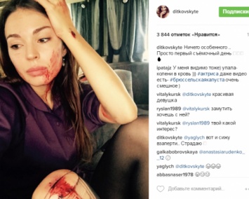 Агния Дитковските опубликовала фото с травмами и ссадинами