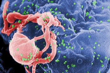 Иммунологи «написали» портрет устойчивого к ВИЧ человека