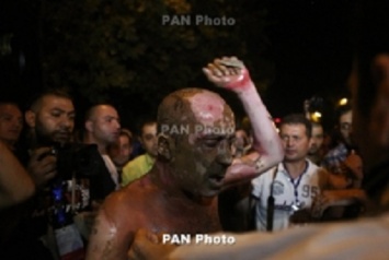 Акт самосожжения во время митинга в Ереване (ФОТО)