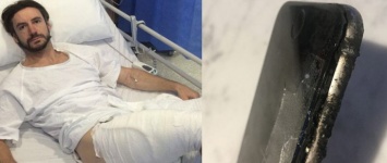 Австралийцу пересадили кожу после «взрыва» iPhone 6
