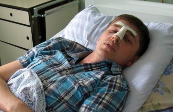 В Житомире пациент напал на врача, сломал ему нос и нанес закрытую черепно-мозговую травму