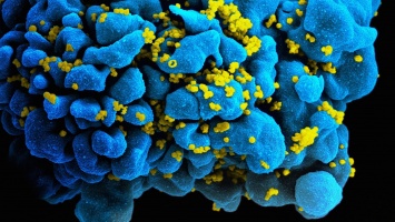 Репликацию ВИЧ остановили блокировкой мембранных пор