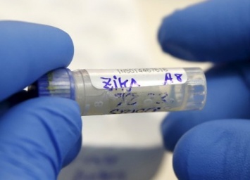 Вирус Зика обнаружили в сперме через полгода после заражения