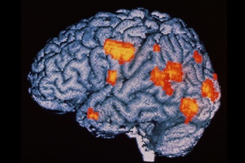Физические нагрузки могут облегчить симптомы шизофрении - ученые
