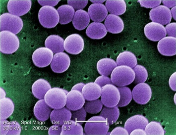 Микробиологи научились убивать стафилококк солью