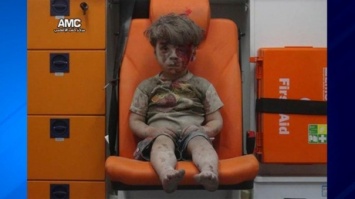Кадры с окровавленным мальчиком в Алеппо шокировали мир