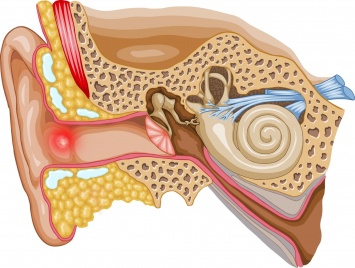 Потерю слуха и вертиго можно диагностировать с помощью анализа крови