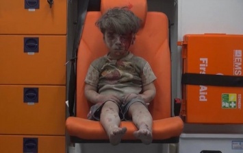 Это душераздирающее фото облетело Интернет: малыш после авиаудара в Сирии