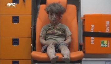 В Сирии брат названного "символом войны" мальчика скончался от полученных ранений