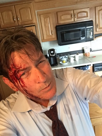 Чарли Шин показал себя в крови после несчастного случая