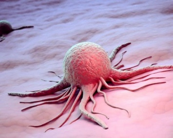 Ученые назвали симптомы, указывающие на ранние стадии рака