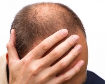 Ученые: Новый препарат восстанавливает рост волос у пациентов с гнездной алопецией