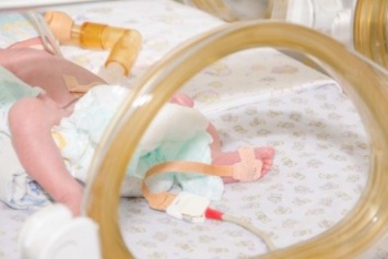 На Днепропетровщине спасли более 200 недоношенных малышей