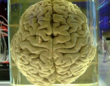 Выдающееся собрание умов: зачем бельгийской клинике 3000 мозгов в формалине?