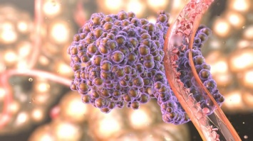 Ученые: Лекарство от гриппа может остановить образование метастаз при раковых заболеваниях