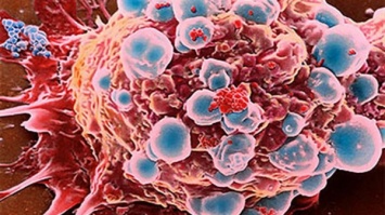 Ученые: Наночастицы из железа станут эффективныс средство для борьбы с раком
