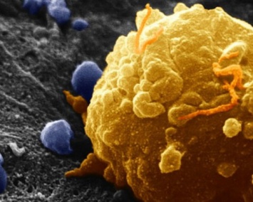 Ученые: Наночастицы железа помогут в борьбе с раком